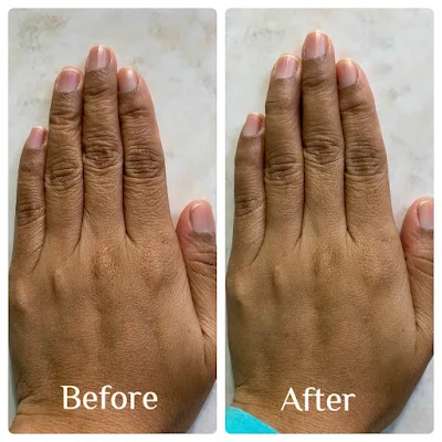 Before After pemakaian Loving Body Serum