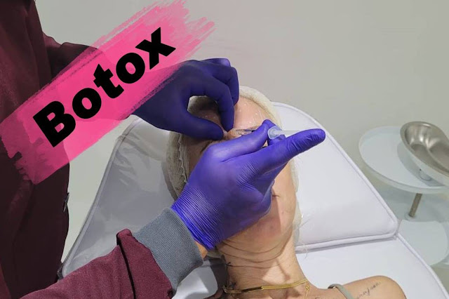 Botox 3 Regiões