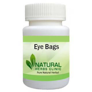 Natural Remedies for Eye Bags