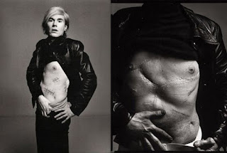 Andy Warhol after the assassination attempt