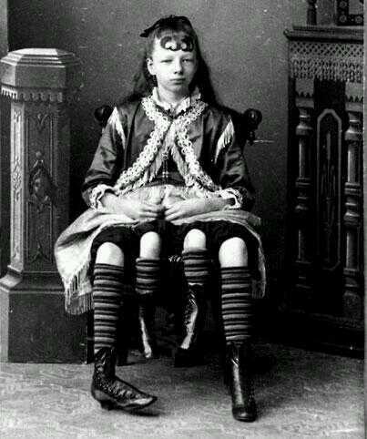 Josephine Myrtle Corbin: La mujer con cuatro piernas que encontró el amor