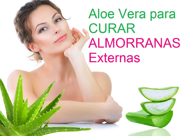 Aloe-Vera-para-Almorranas-Externas-Remedios-Caseros