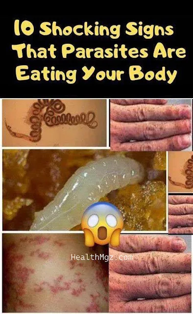 10 Shocking Signs Proving That Parasites Are Eating Your Body