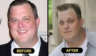 billy gardell weight loss before and after