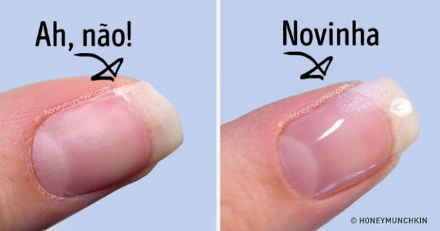 Aprenda 9 dicas para manter as unhas lindas e saudáveis