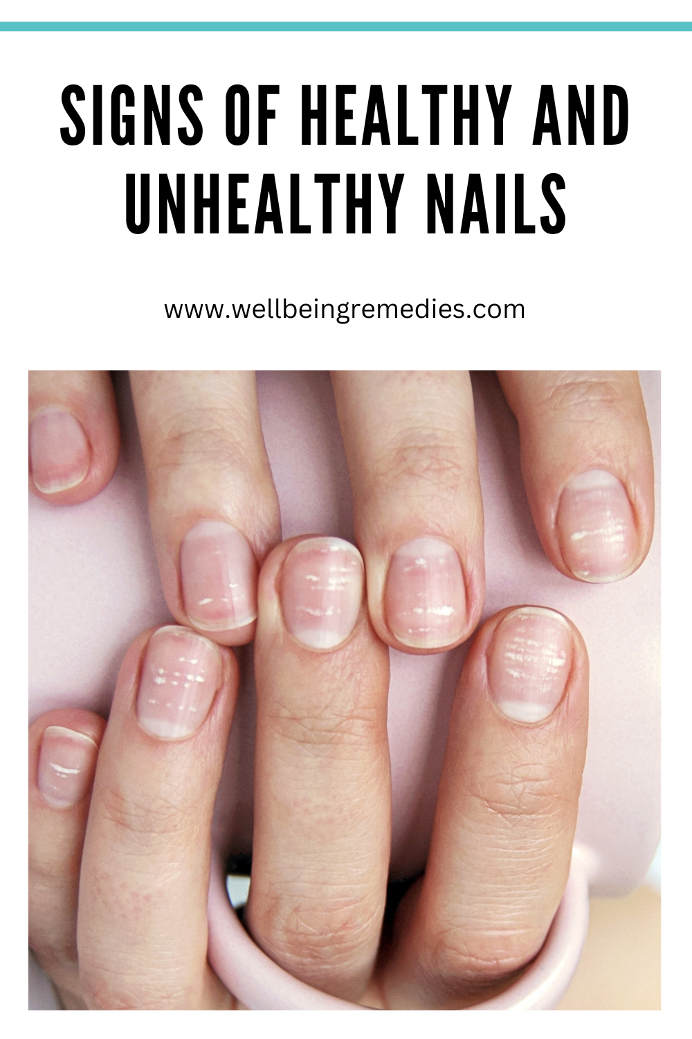 Signs of Healthy and Unhealthy Nails