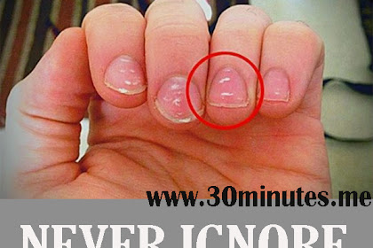 This Is What Your Fingernails Say About Your Health