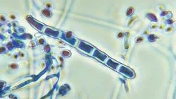 Trichophyton