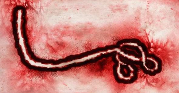 Virus Ebola Diamati Pada Mikroskop