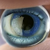 World's First Bionic Eye Receives FDA Approval