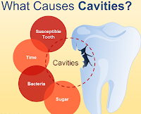 http://www.dental-clinic-delhi.com/dental-fillings.html