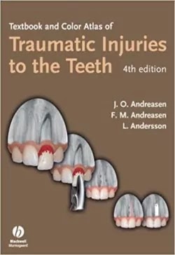 Download Textbook and Color Atlas of Traumatic Injuries To the Teeth 4th Edition PDF