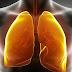 Home Remedies Helps You to Purify Your Lungs In 72 Hours