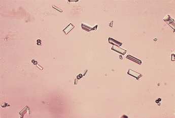 LAB PATOLOGI KLINIK Urinalysis sedimen 