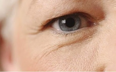  Biểu hiện và cách khắc phục của sụp mí mắt 