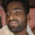 Ghazipur News: शादी में युवक पर स्टेपलर पिन से हमला, बीएचयू में 2 घंटे तक चला आपरेशन