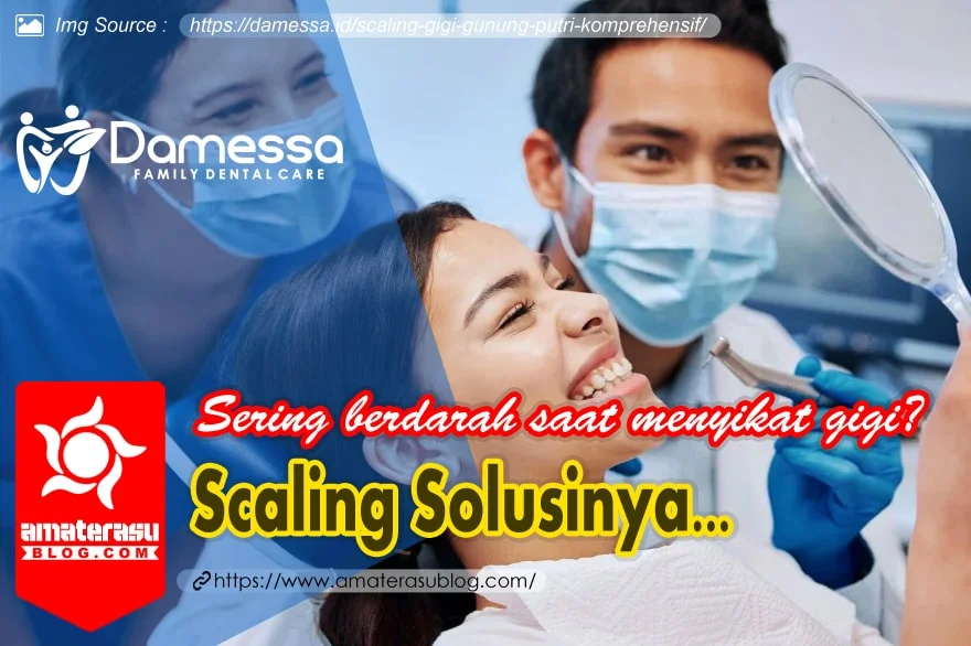 penyebab gusi berdarah saat menyikat gigi dan solusinya dengan scaling