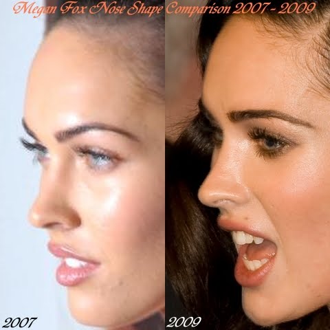 megan fox plastic surgery nose. the 2009#39;s Megan Fox nose