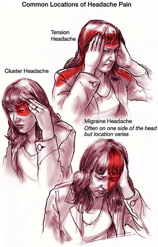 Migraine Head Ache Homeopathy Treatment Chennai Tamil Nadu Migraine Head Ache Homeopathy Treatment Chennai Tamil Nadu