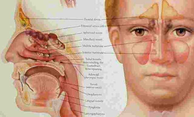 Sinusitis Symptoms And Treatment