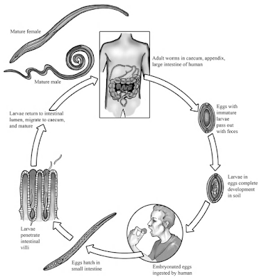 gambar siklus hidup Trichuris trichiura