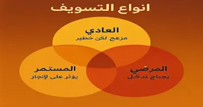 أنواع التسويف