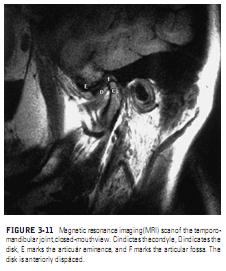 Magnetic Resonance Imaging