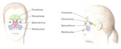 penggolongan sinusitis