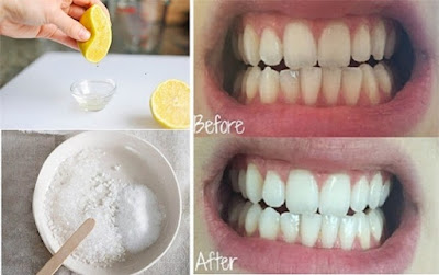 Cách làm trắng răng bằng baking soda và chanh