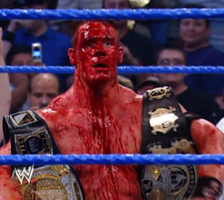 John Cena with blood coming from head