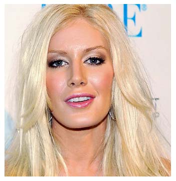 lady gaga before plastic surgery before after. Heidi Montag Before After
