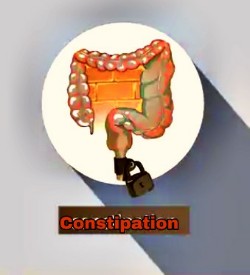 Constipation