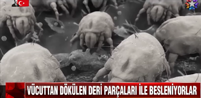 dökülen deri parçaları