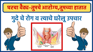 गुदे चे रोग व त्याचे घरेलू उपचार घरचा वैद्य  Anal Disease And Its Home Remedies - गुदे चे रोग व त्याचे घरेलू उपचार