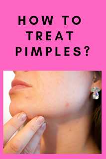 How to treat pimples