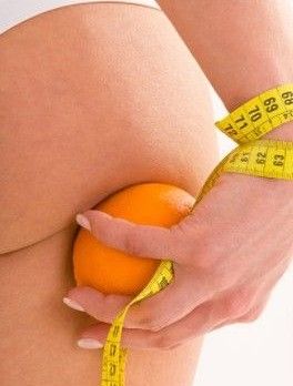 La peau d'orange une des caractéristiques de la cellulite