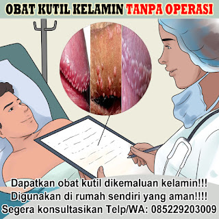 Obat Kutil Kelamin