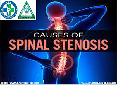 Spine Specialist In New Delhi