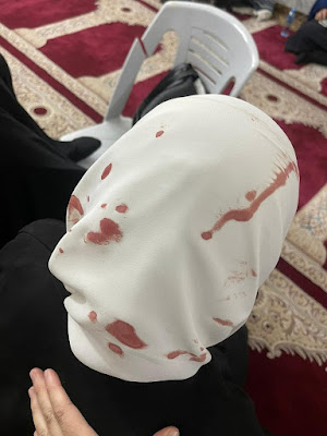 Palestinian woman worshiper injured.