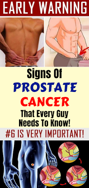 12 Early Warning Signs Of Prostate Cancer That Every Guy Needs To Know!