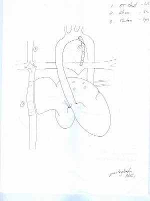 love heart drawings. Love Heart Drawings In Pencil.