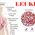 The Risk of Leukemia and Other Forms of Blood Cancer