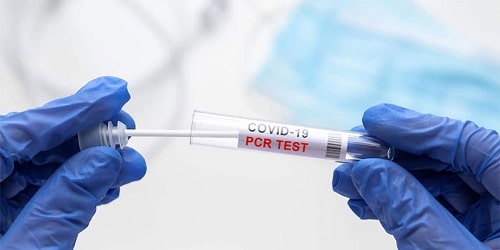 About 1,000 cases of Coronavirus variants reported in south Cyprus