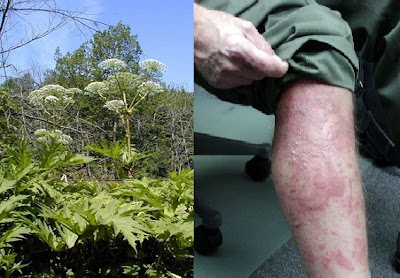 Giant Hogweed Plants are Hazardous