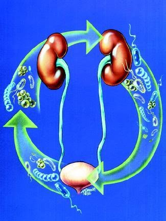 excretory system diseases. excretory system diseases