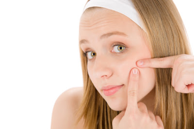 6 Tips on How to Clear up Acne
