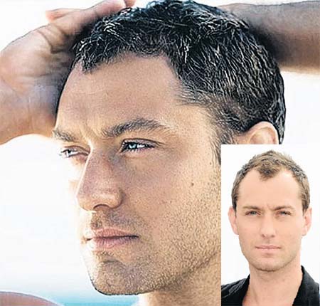 Doctor Gott Hair Loss : Finding A Solution For Hair Loss