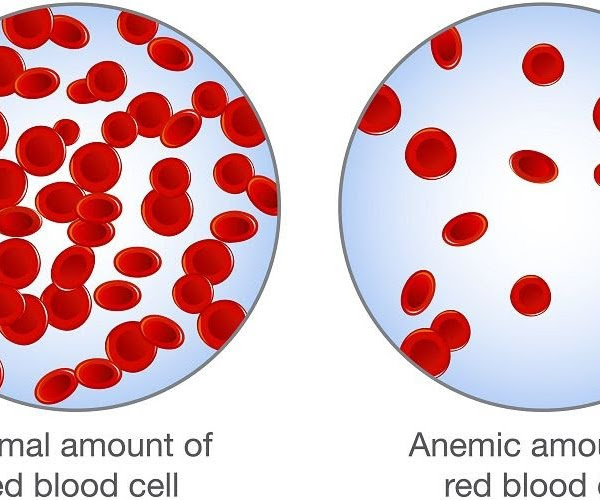 Generasi Bebas dari Anemia Defisiensi Zat Besi (ADB)