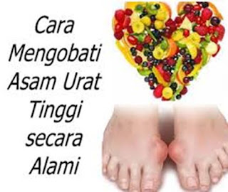 Obat Asam Urat Resmi, Obat Trdisional Penyakit Asam Urat, Resep Obat Asam Urat Alami, Obat Sakit Asam Urat, Cara Ngobati Asam Urat Alami, Askep Kasus Asam Urat Pada Lansia, Jamu Asam Urat Dan Rematik, Mencegah Asam Urat Dan Rematik, Obat Sakit Asam Urat, Obat Bagi Penyakit Asam Urat, Obat Rematik Dan Asam Urat Resep Dokter, Obat Mujarab Buat Penyakit Asam Urat, Asam Urat Apa Bisa Sembuh Total, Asam Urat Di Usia Muda, Obat Asam Urat Tradisional Untuk Ibu Hamil, Makalah Asam Urat Dalam Darah, Asam Urat Berbahaya, Tumbuhan Obat Untuk Penyakit Asam Urat, Asam Urat Jari Kaki, Asam Urat Mengobati, Asam Urat Makanan Tidak Boleh, Terapi Farmakologi Asam Urat, Jamu Herbal Asam Urat Dan Kolesterol, Lobak Penyebab Asam Urat, Sayuran Pantangan Asam Urat Dan Kolesterol, Cara Mengobati Asam Urat Dengan Ramuan Herbal, Asam Urat Penyebab Stroke, Cara Mengobati Asam Urat Yang Sedang Kambuh, Asam Urat Kaki Lemas, Cara Mengobati Asam Urat Dengan Semut Jepang 