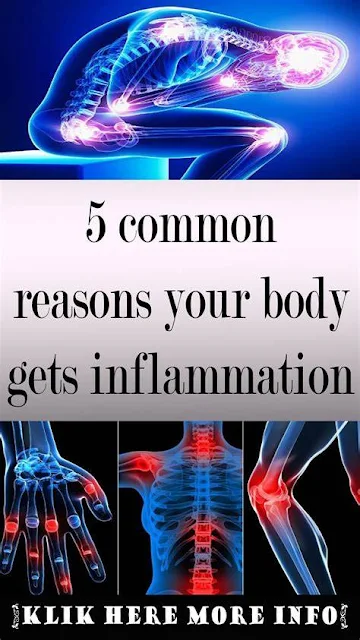 5 Common Reasons Your Body Gets Inflamamation
